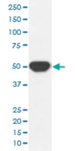 PTPN1 Rabbit anti-Human, Unconjugated, Clone: IHG-16, Abnova 100 &mu;g;