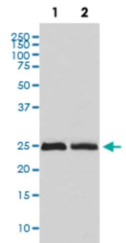 RAB4A Rabbit anti-Human, Unconjugated, Clone: CCI-18, Abnova 100 &mu;g;
