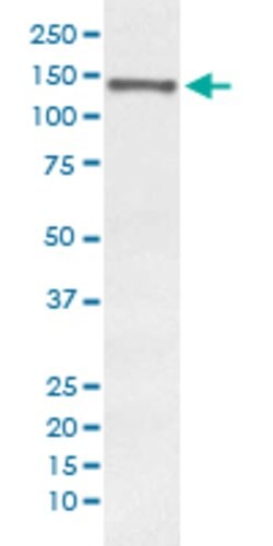 RPTOR Rabbit anti-Human, Unconjugated, Clone: EGB-18, Abnova 100 &mu;g | Buy Online | Abnova Corporation | Fisher Scientific