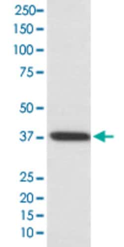 RHO Rabbit anti-Human, Unconjugated, Clone: AADI-18, Abnova 100 &mu;g;