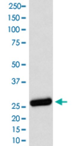 SDHB Rabbit anti-Human, Unconjugated, Clone: ABDF-19, Abnova 100 &mu;g;