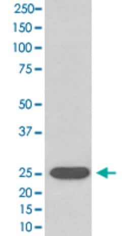 SOD2 Rabbit anti-Human, Unconjugated, Clone: IDO-19, Abnova 100 &mu;g | Buy Online | Abnova Corporation | Fisher Scientific