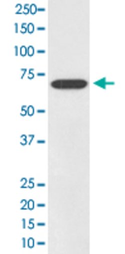 SOX11 Rabbit anti-Human, Unconjugated, Clone: GIO-19, Abnova 100 &mu;g | Buy Online | Abnova Corporation | Fisher Scientific