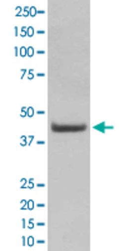 SOX18 Rabbit anti-Human, Unconjugated, Clone: DCD-19, Abnova 100 &mu;g;