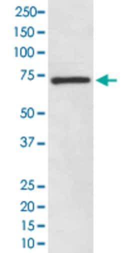 SOX9 Rabbit anti-Human, Unconjugated, Clone: DAO-19, Abnova 100 &mu;g | Buy Online | Abnova Corporation | Fisher Scientific