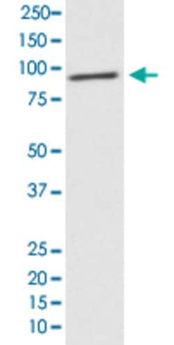 STAT2 Rabbit anti-Human, Unconjugated, Clone: HCB-19, Abnova 100 &mu;g;