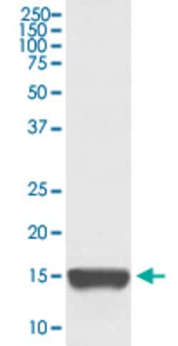 TNFRSF12A Rabbit anti-Human, Unconjugated, Clone: GFF-20, Abnova 100 &mu;g | Buy Online | Abnova Corporation | Fisher Scientific