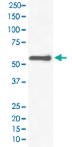 TH Rabbit anti-Human, Unconjugated, Clone: GOO-20, Abnova 100 &mu;g; Unconjugated:Antibodies,