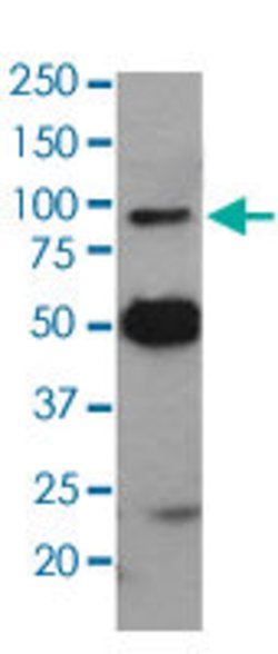 VCP Rabbit anti-Human, Mouse, Rat, Unconjugated, Clone: AAGD-22, Abnova