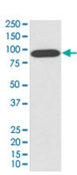 VCP Rabbit anti-Human, Mouse, Rat, Unconjugated, Clone: AAGD-22, Abnova