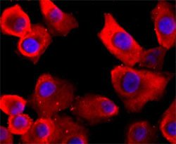 VCP Rabbit anti-Human, Mouse, Rat, Unconjugated, Clone: AAGD-22, Abnova