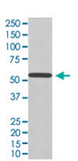 WT1 Rabbit anti-Human, Mouse, Unconjugated, Clone: CEH-23, Abnova 100 &mu;g | Buy Online | Abnova Corporation | Fisher Scientific