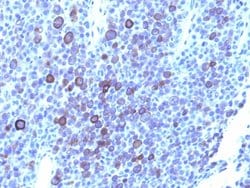 GPC3 Mouse anti-Human, Unconjugated, Clone: 1G12 + GPC3/863, Abnova 100