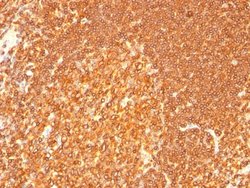 HLA-DRB1 Mouse anti-Human, Unconjugated, Clone: LN-3 + HLA-DRB/1067, Abnova