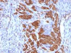 CNN1 Mouse anti-Human, Unconjugated, Clone: CNN1/832 + CALP, Abnova 100