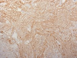 FN1 Mouse anti-Human, Unconjugated, Clone: HFN7.1, Abnova 100 &mu;g; Unconjugated:Antibodies,