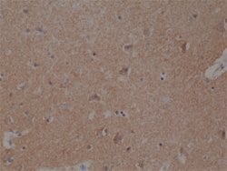 SPAST Rabbit anti-Human, Unconjugated, Clone: RM346, Abnova 100 &mu;L;