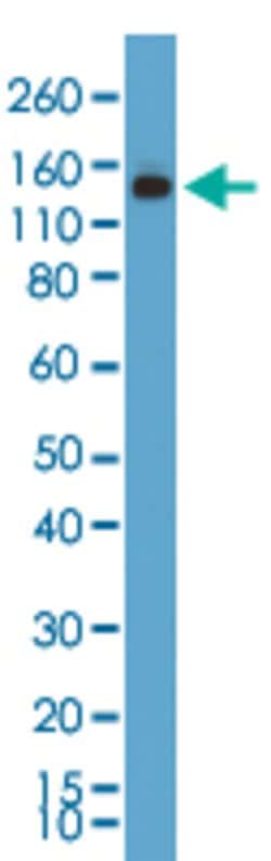 MSH6 Rabbit anti-Human, Unconjugated, Clone: RM376, Abnova&trade;