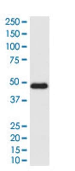 CXCR3 Rabbit anti-Human, Unconjugated, Clone: ACFD-3, Abnova™
