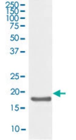 IL10 Rabbit anti-Human, Unconjugated, Clone: AOIG-9, Abnova™