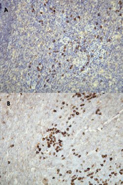 Kappa light chain, Rabbit, Clone: A21-Y, Abnova 100&mu;L; Unlabeled:Antibodies,