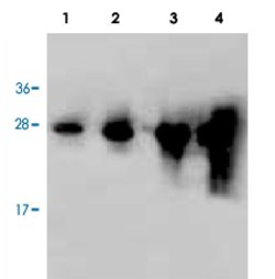 YFP, Rabbit, Polyclonal Antibody, Abnova 100&mu;g; Unlabeled:Antibodies,