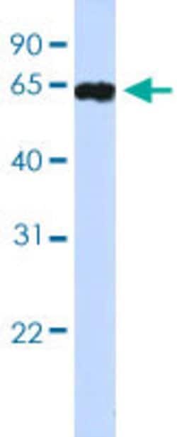 HIC2 Rabbit anti-Human, Polyclonal, Abnova 100uL:Antibodies, Polyclonal