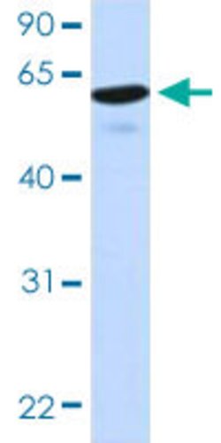 HIC2 Rabbit anti-Human, Polyclonal, Abnova 100uL:Antibodies, Polyclonal