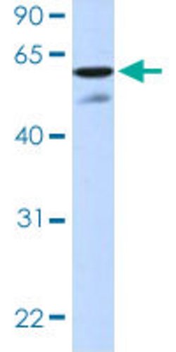 HIC2 Rabbit anti-Human, Polyclonal, Abnova 100uL:Antibodies, Polyclonal