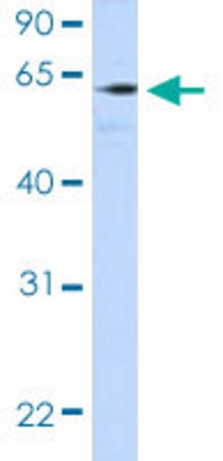 HIC2 Rabbit anti-Human, Polyclonal, Abnova 100uL:Antibodies, Polyclonal