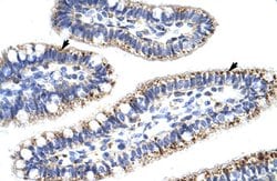 KLHL13 Rabbit anti-Human, Polyclonal, Abnova 100uL:Antibodies, Polyclonal