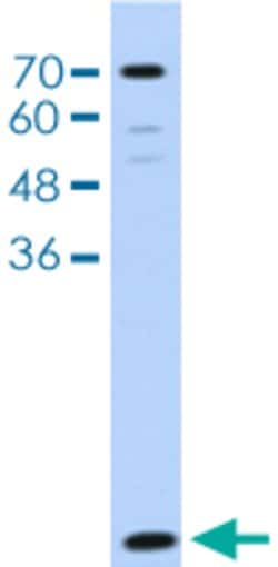 LSM2 Rabbit anti-Human, Polyclonal, Abnova 100uL:Antibodies, Polyclonal