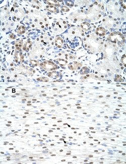 LSM2 Rabbit anti-Human, Polyclonal, Abnova 100uL:Antibodies, Polyclonal