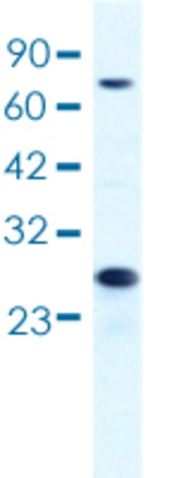 MCM6 Rabbit anti-Human, Polyclonal, Abnova 100 &mu;L | Buy Online | Abnova | Fisher Scientific