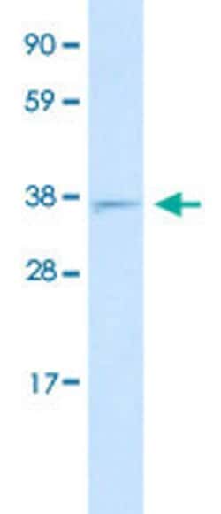 MXI1 Rabbit anti-Human, Polyclonal, Abnova 100uL:Antibodies, Polyclonal