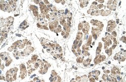 SSR2 Rabbit anti-Human, Polyclonal, Abnova 100uL:Antibodies, Polyclonal
