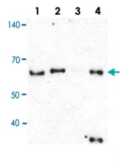 HNRNPH1 Rabbit anti-Human, Polyclonal, Abnova 100uL:Antibodies, Polyclonal
