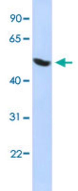 HNRNPH1 Rabbit anti-Human, Polyclonal, Abnova 100uL:Antibodies, Polyclonal