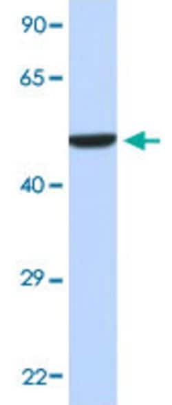 HNRNPH1 Rabbit anti-Human, Polyclonal, Abnova 100uL:Antibodies, Polyclonal