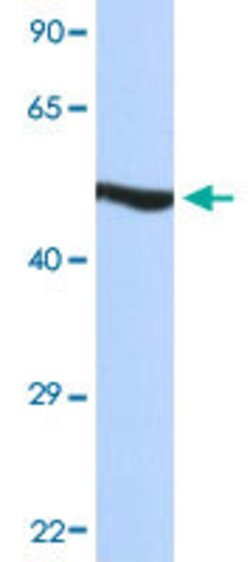 HNRNPH1 Rabbit anti-Human, Polyclonal, Abnova 100uL:Antibodies, Polyclonal