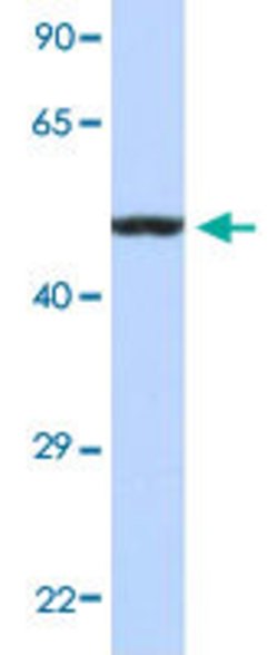 HNRNPH1 Rabbit anti-Human, Polyclonal, Abnova 100uL:Antibodies, Polyclonal