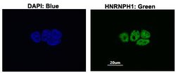 HNRNPH1 Rabbit anti-Human, Polyclonal, Abnova 100uL:Antibodies, Polyclonal