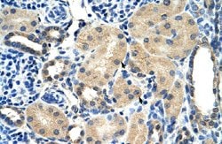 AIP Rabbit anti-Human, Polyclonal, Abnova 100uL:Antibodies, Polyclonal