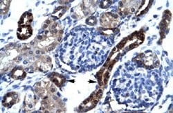 SFRS17A Rabbit anti-Human, Polyclonal, Abnova 100uL:Antibodies, Polyclonal