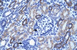 ACCN3 Rabbit anti-Human, Polyclonal, Abnova 100uL:Antibodies, Polyclonal