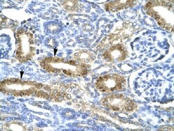 CHRND Rabbit anti-Human, Polyclonal, Abnova 100uL:Antibodies, Polyclonal