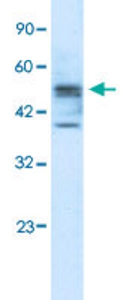 CHST4 Rabbit anti-Human, Polyclonal, Abnova 100 &mu;L | Buy Online | Abnova | Fisher Scientific