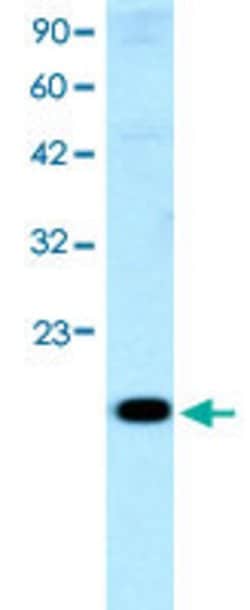 CITED1 Rabbit anti-Human, Polyclonal, Abnova 100uL:Antibodies, Polyclonal