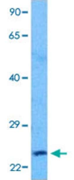 CITED1 Rabbit anti-Human, Polyclonal, Abnova 100uL:Antibodies, Polyclonal