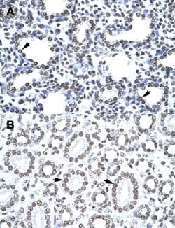 CITED1 Rabbit anti-Human, Polyclonal, Abnova 100uL:Antibodies, Polyclonal